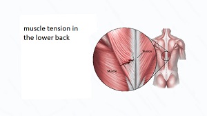 muscle tension in the lower back